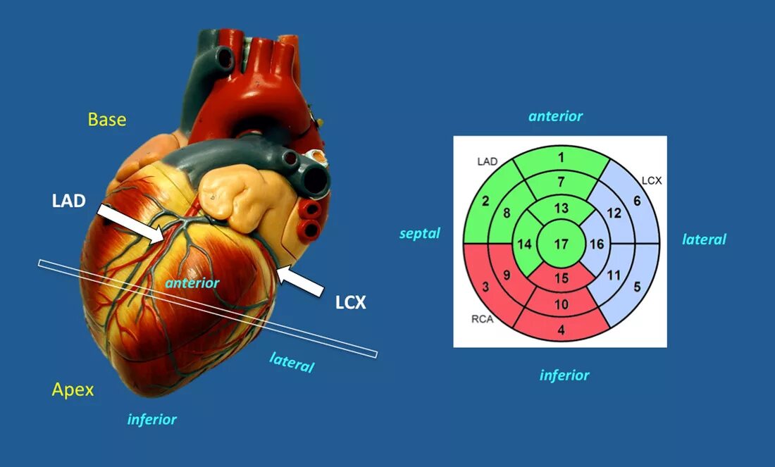 Локальная сократимость левого желудочка. Зоны левого желудочка ЭХОКГ. Сегменты миокарда при ЭХОКГ. Сегментарная модель сердца. Сегменты сердца по УЗИ.
