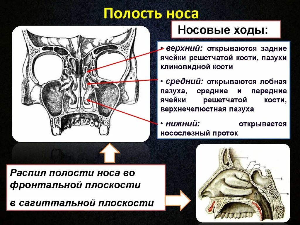 В верхний носовой ход открывается пазуха. Носовые раковины сообщения с пазухами. Верхняя и средняя носовые раковины структуры кости. Носовая полость строение кости. Соустья пазух носа анатомия.