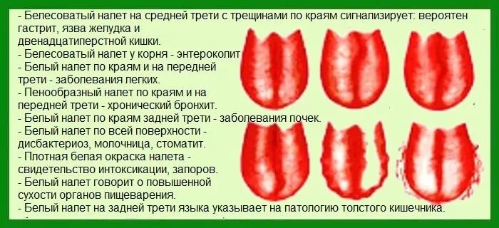 Кончик языка лучше различает. Язык белый белый налет. Язык белый налет на языке.