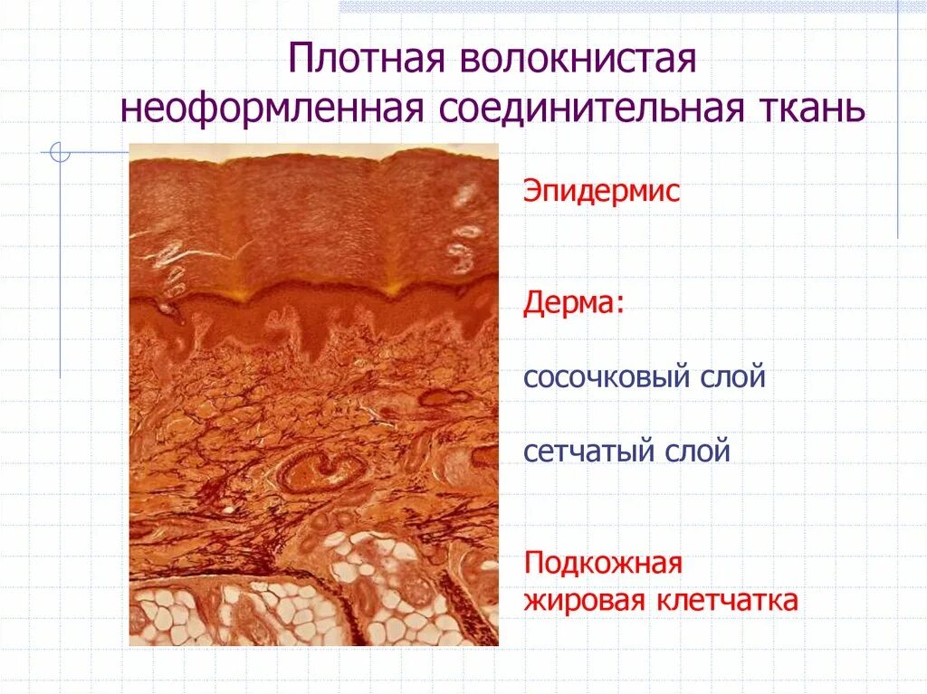 Плотная волокнистая неоформленная соединительная ткань кожа пальца. Плотная неоформленная соединительная ткань орсеин. Плотная неоформленная соединительная ткань сетчатый слой дермы. Плотная соединительная ткань сетчатого слоя кожи.