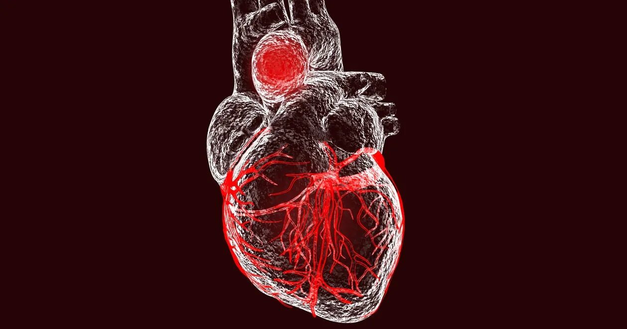 Аневризма сердца патанатомия. Хроническая аневризма сердца. Стенка хронической аневризмы сердца. Аневризма левого желудка. Операции при аневризмах сердца.