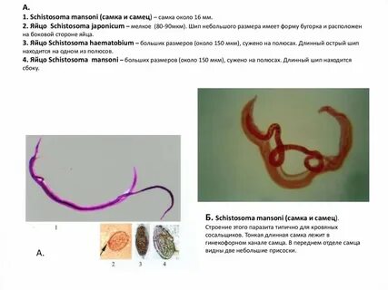 Шистосомоз японский это