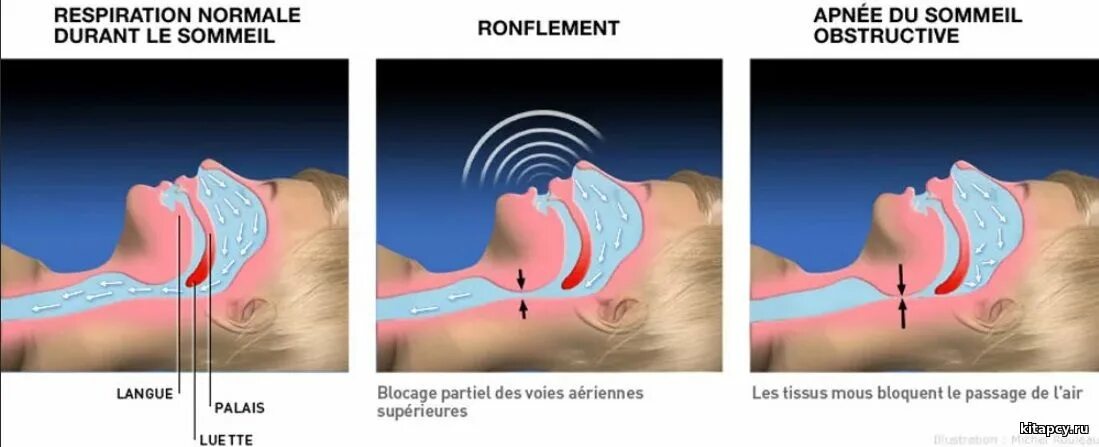 Ночью язык прилипает к небу. Артикуляционная гимнастика для детей грибок. Полость рта, строение, функция. Ночью язык прилипает к небу. Грибковый (кандидозный) стоматит.