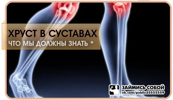 Хрустят суставы при вращении. Суставы хрустят причина. хруст в суставах причины.