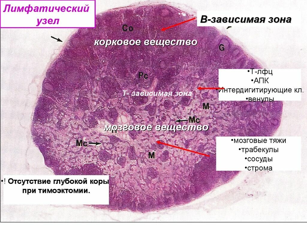 Лимфатический узел гистология. Лимфоидные фолликулы селезенки. Лимфатический узел гистология схема. Строение лимфатического узла гистология.