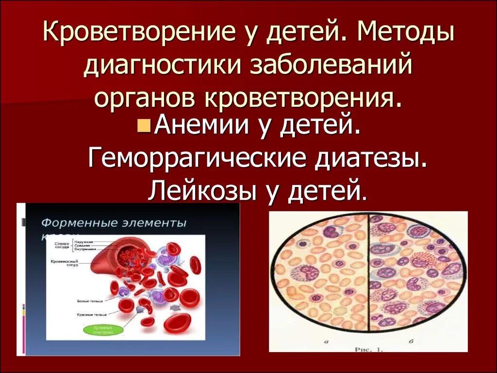 Заболевание крови диагноз. Болезни системы крови анемия, лейкоз у детей. Анемия заболевание органов кроветворной системы. Поражений системы кроветворения у детей. Болезнь крови и кроветворных органов неуточненная.