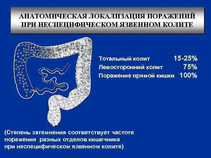 Колика при колите. Неспецифический язвенный колит патанатомия. Неспецифический язвенный колит ФГДС. Неспецифический язвенный колит локализация. Няк поражение Толстого кишечника.