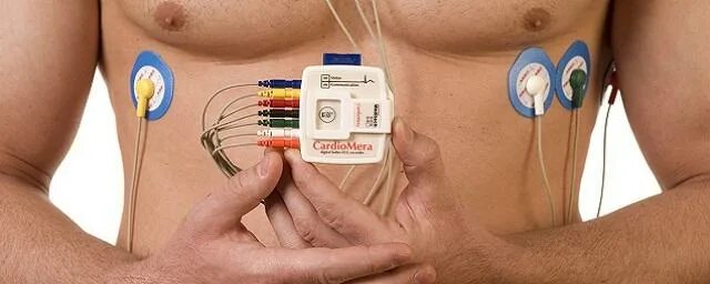 Холтеровское мониторирование что это такое и что. Холтеровское мониторирование. суточный мониторинг сердца. холтер на сердце.