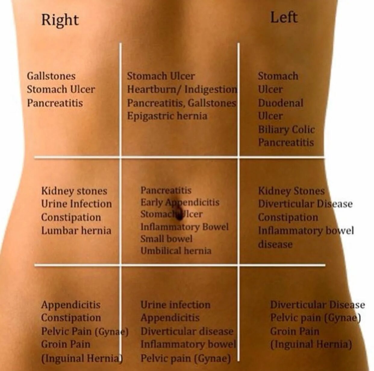 Правая сторона покалывает. Боль в правом боку. Части живота у женщин. Боль в животе слева. Болит в области живота справа.