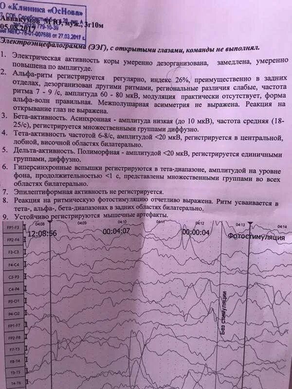 Ээг норма расшифровка. Норма Альфа ритма головного мозга при ЭЭГ. ЭЭГ показатели нормы. ЭЭГ нормальные показатели. Электроэнцефалография (ЭЭГ) расшифровка.