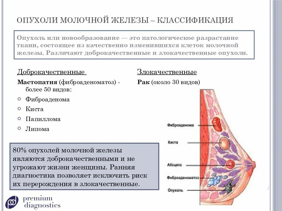 Маммография норма и патология снимки. Дольчатая фиброаденома. Доброкачественные изменения молочной железы что это. Доброкачественные новообразования молочной железы. Фиброаденома молочной железы размеры для операции.