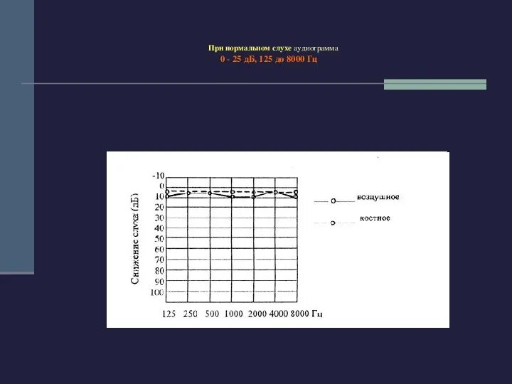 Аудиограмма норма. Аудиограмма слуха норма. Тоннельная аудиограмма. 125 Гц до 8000 аудиограмма. Аудиограмма при нормальном слухе.