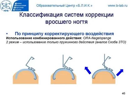 Система скобу