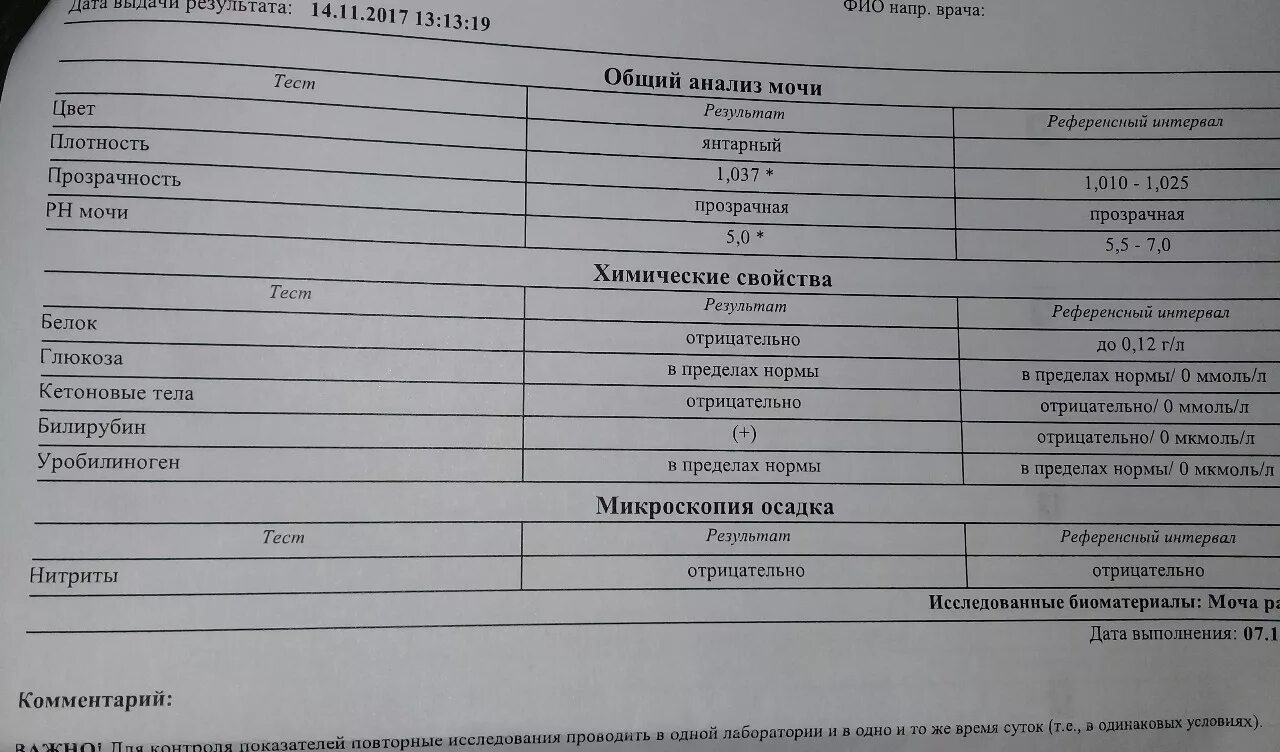 Уробилиноген в моче у мужчины повышены. Норма непрямого билирубина в моче. Билирубин в моче в норме. Прямой билирубин в моче в норме. Анализ мочи билирубин норма.