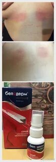 Белодерм лосьон