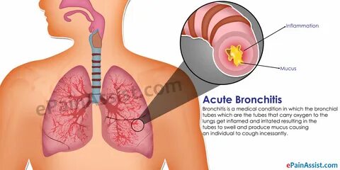 Symptoms of both acute and chronic bronchitis include breathing problems su...