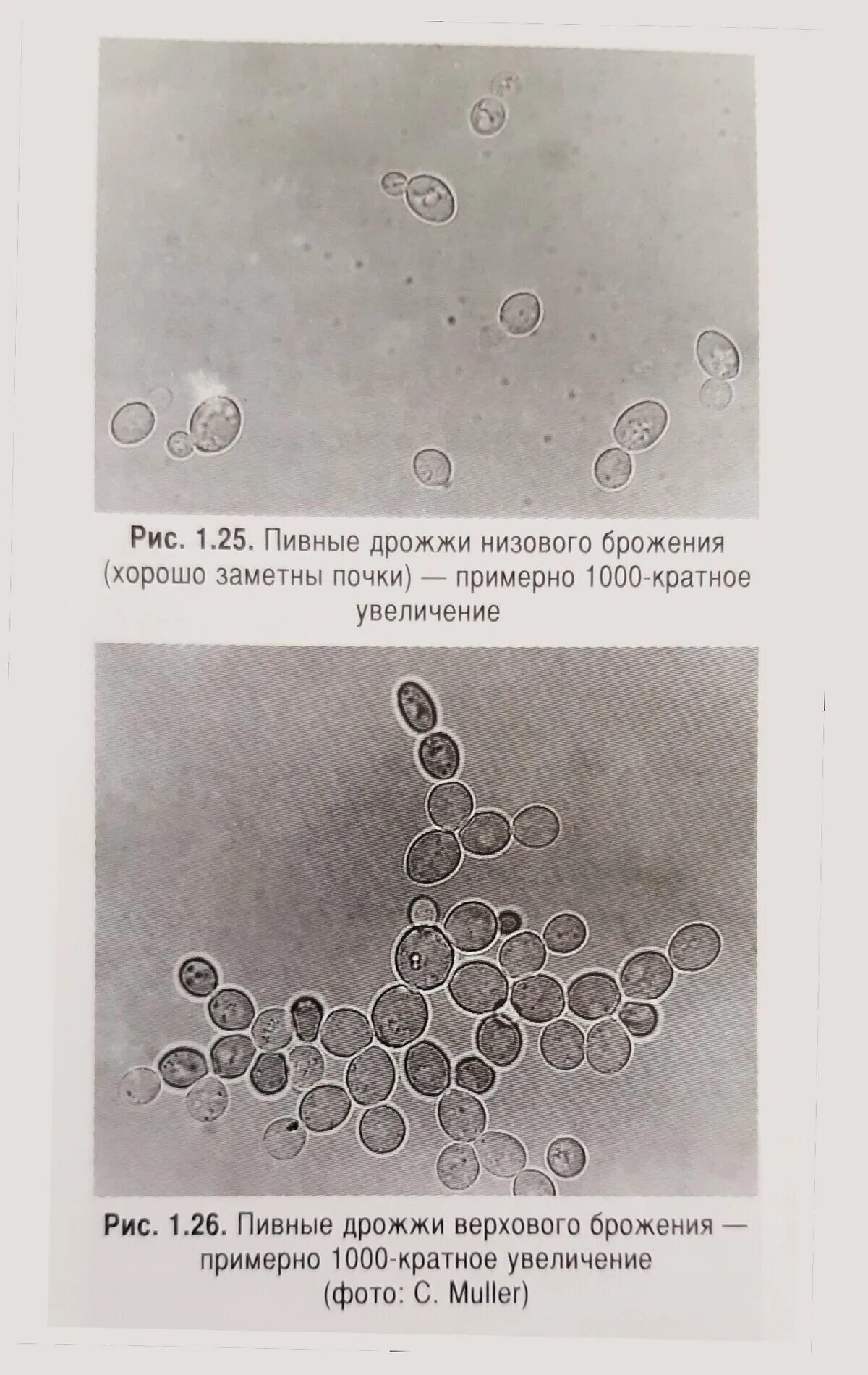 Дрожжи дикие и культурные. Пивоваренные дрожжи низового брожения под микроскопом. Термофильные дрожжи под микроскопом. Дрожжей Saccharomyces cerevisiae верхового. Пекарские дрожжи под микроскопом.