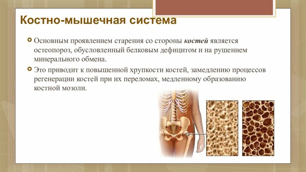 Основным признаком возрастных изменений костей. Заболевания костно-мышечной системы. Старение костно мышечной системы. Старение костной системы. Возрастные изменения костно мышечной системы.