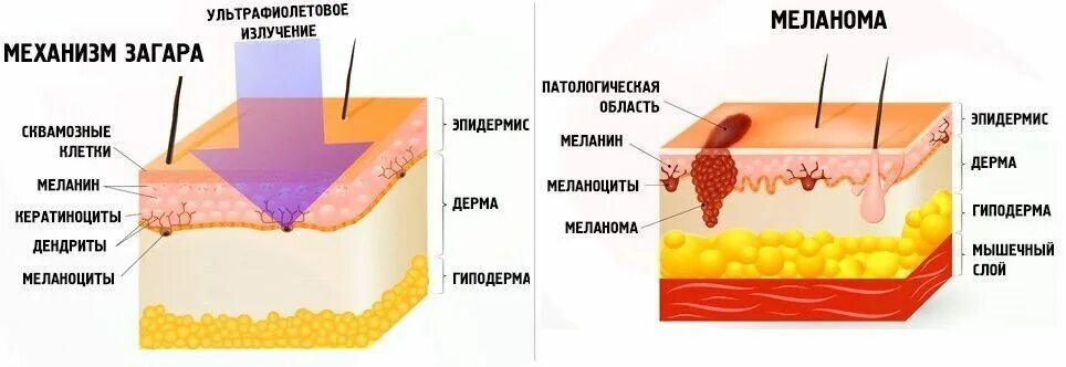 Меланин схема кожи. Меланин в эпидермисе. Меланин защищает от УФ-лучей. Защита от УФ лучей кожа.