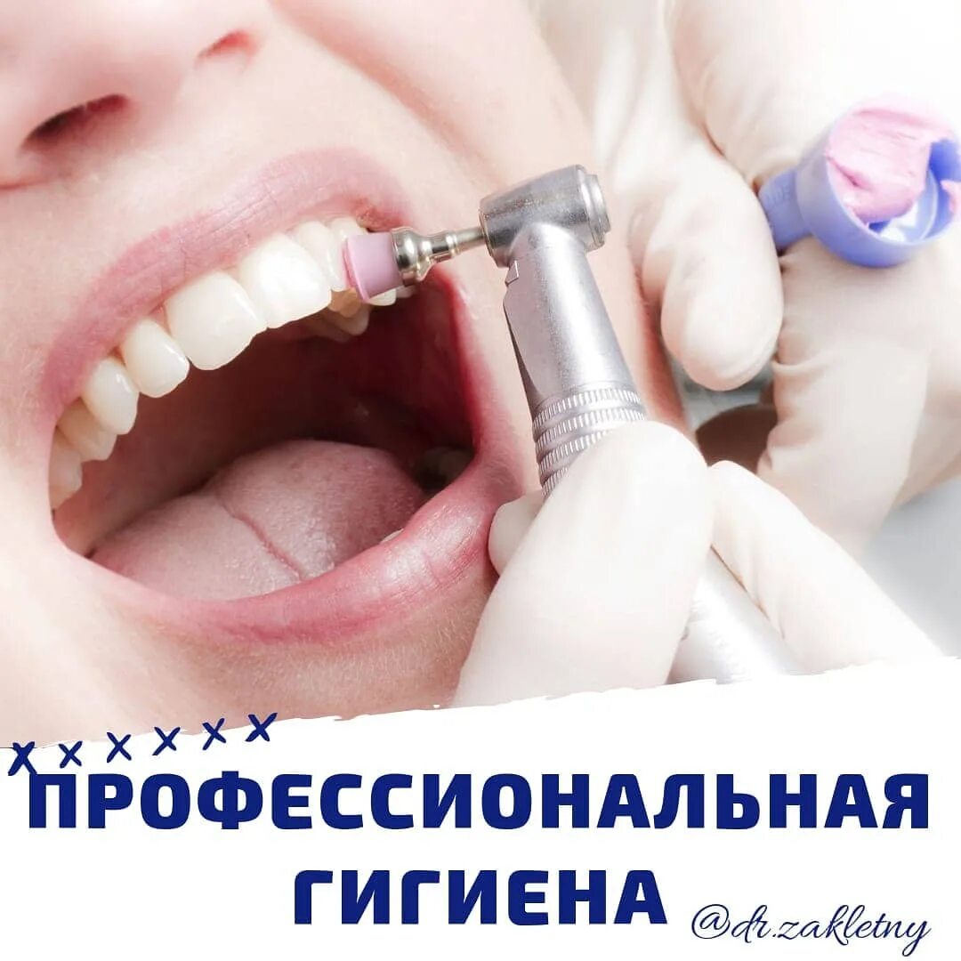 Чистка зубов казань. Профгигиена (ультразвук + Air-Flow). Профессиональная гигиена полости рта. Профессиональная чистка зубов. Профессиональная гигиена зубов.