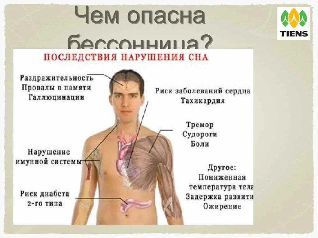 Какие последствия могут быть из за. Последствия нарушения сна. последствия несоблюдения режима дня. последствия нарушения режима сна. несоблюдение режима сна и бодрствования.