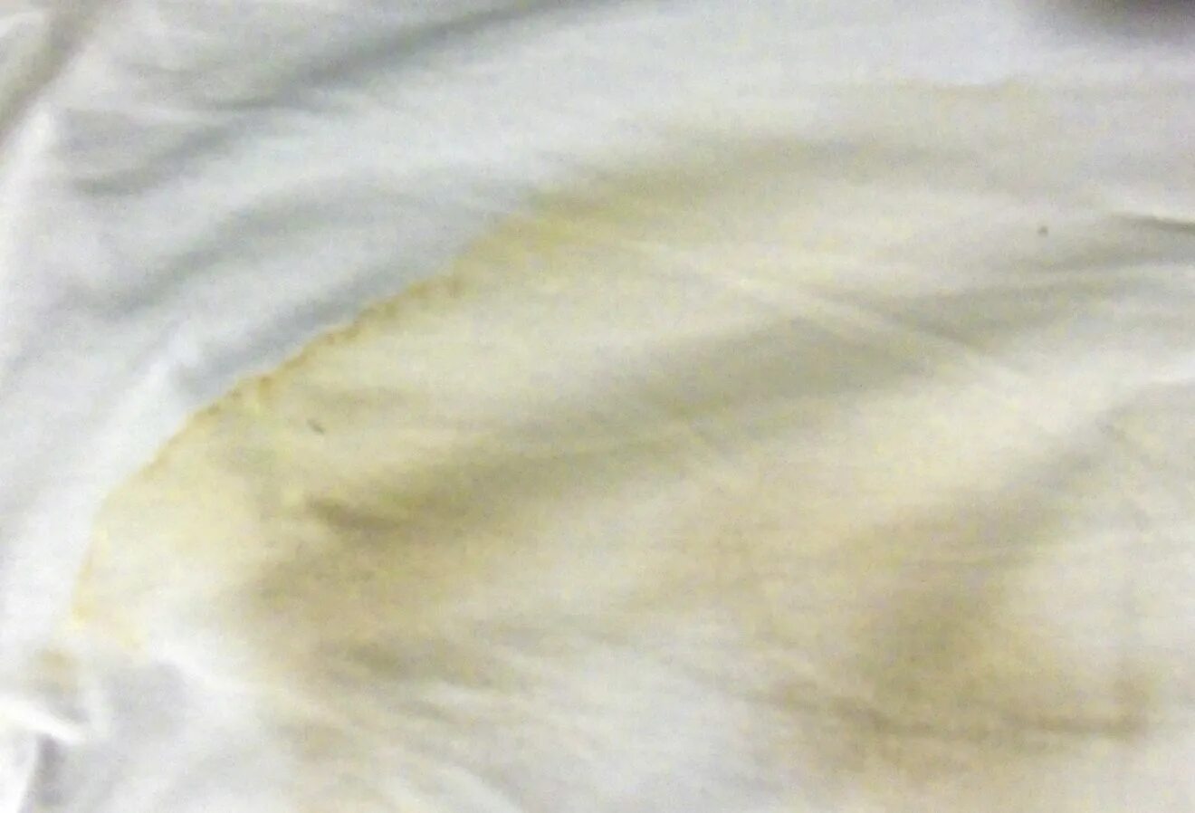 Жёлтые пятна на белой одежде. Ткань с желтыми пятнами. Желтые пятна на постельном белье.