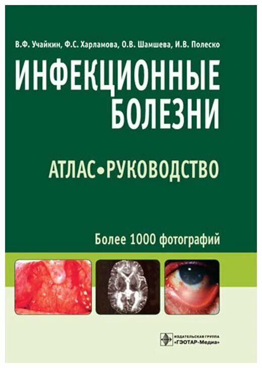 учебник инфекционные заболевания покровский. брико зуева покровский сергиев шкарин 1 том эпидемиология. сборник инфекционных болезней. книга инфекционные заболевания ющук. сборник инфекционных болезней.