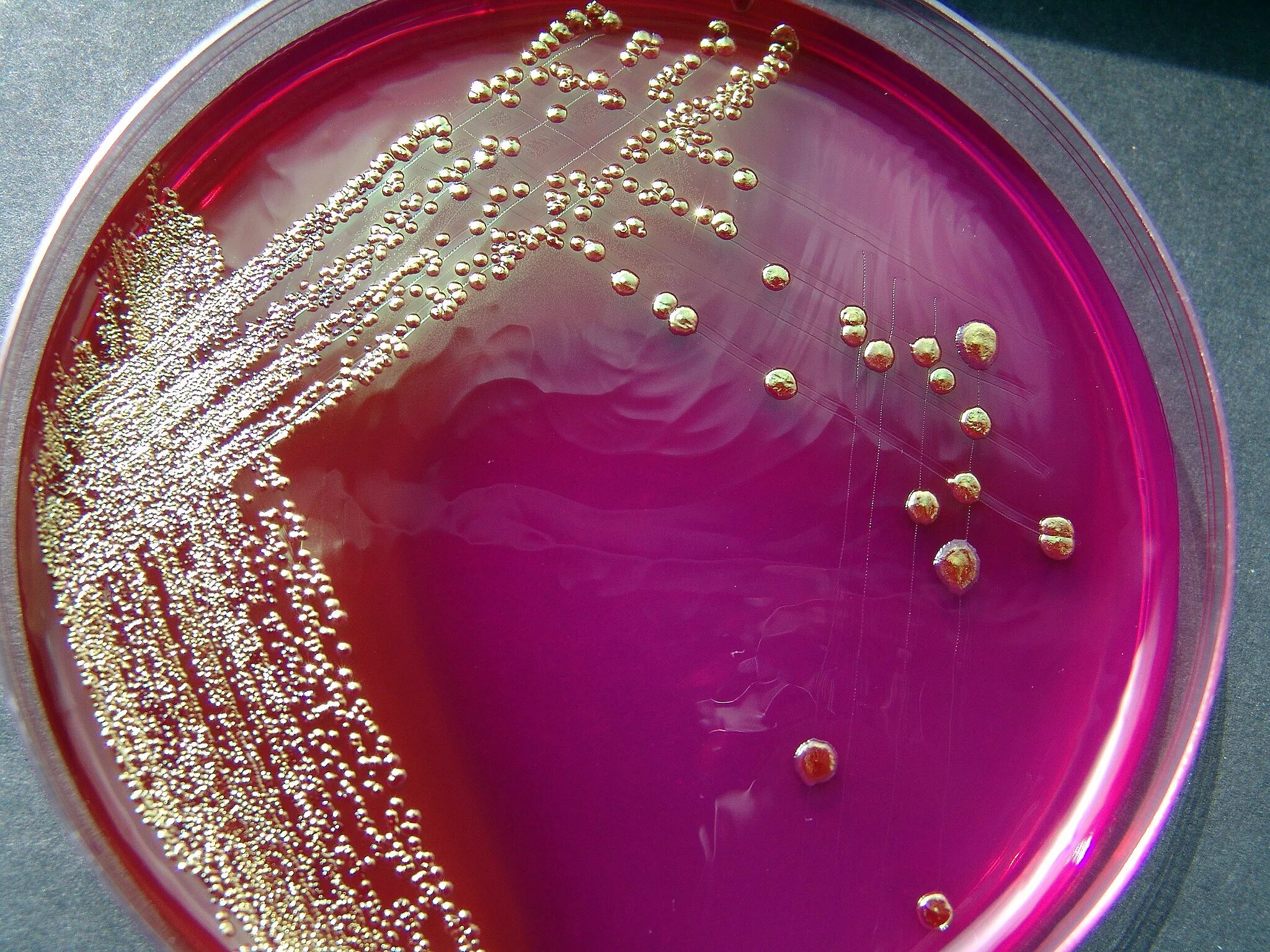 Кишечная палочка энтерококк. Эшерихия на чашке Петри. Escherichia coli на среде Эндо. Escherichia coli в чашке Петри. Рост эшерихии на среде Эндо.