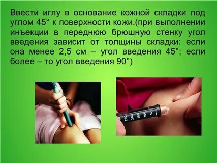 Угол введения иглы при подкожной инъекции