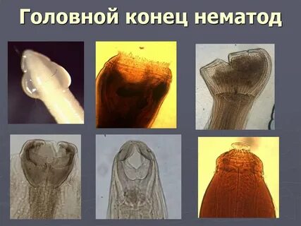 Головной конец