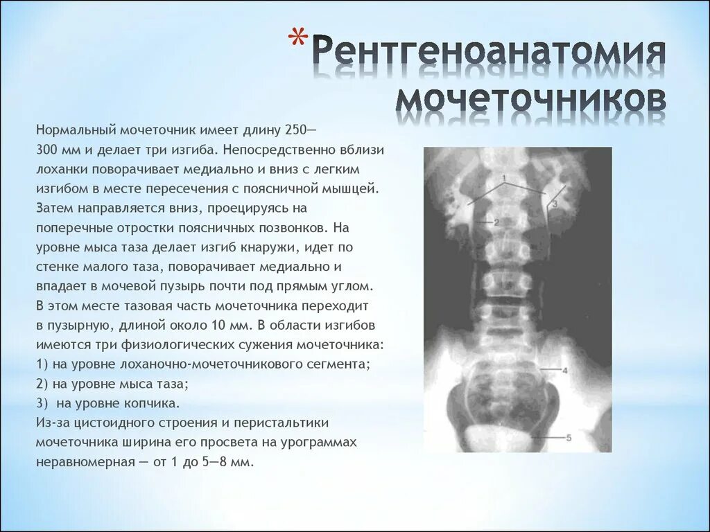 Изгибы мочеточника. Рентген анатомия мочевыделительной системы. Сужение мочеточника кт. Рентгеноанатомия мочеточника. Сегменты мочеточника рентген.