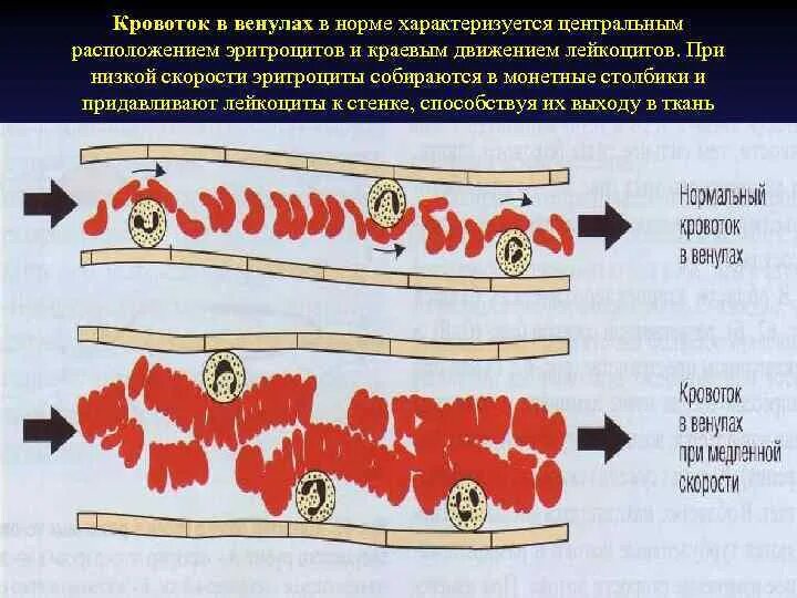 Нормальному кровообращению. Монетные столбики эритроцитов. Скорость кровотока в венулах. Образование монетных столбиков эритроцитов физиология.