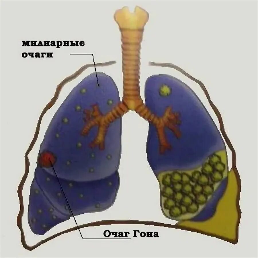 Очаг симон. Очаг симон