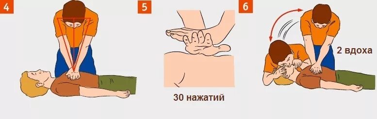 Соотношение вдохов и надавливаний на грудную клетку