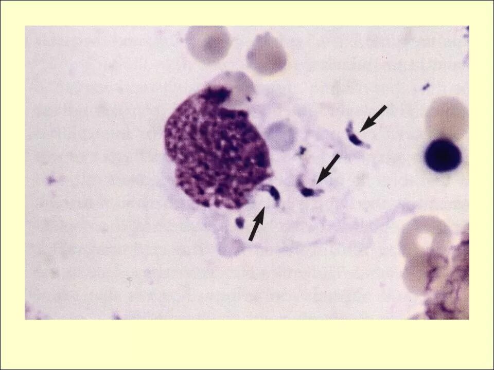 Паразитические простейшие токсоплазма. Возбудитель toxoplasma gondii. Жизненный цикл паразита toxoplasma gondii. Токсоплазма апикомплексы. Токсоплазма gondii.
