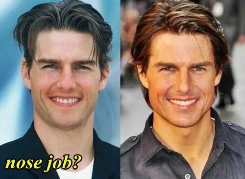 Том Круз ринопластика. Нос Тома Круза. Том Круз операции. Tom Cruise after Plastic. Операции тома круза