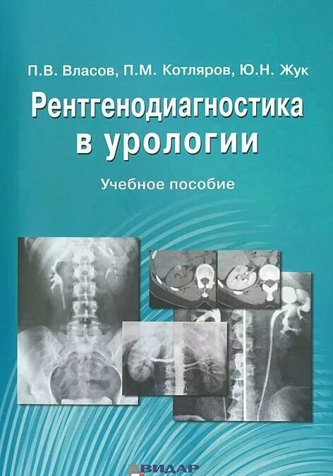 Лет в урологии. Рентгенодиагностика в урологии. Власов рентгенодиагностика. Методы рентгенодиагностики урологических заболеваний. Лучевая диагностика в урологии книги.