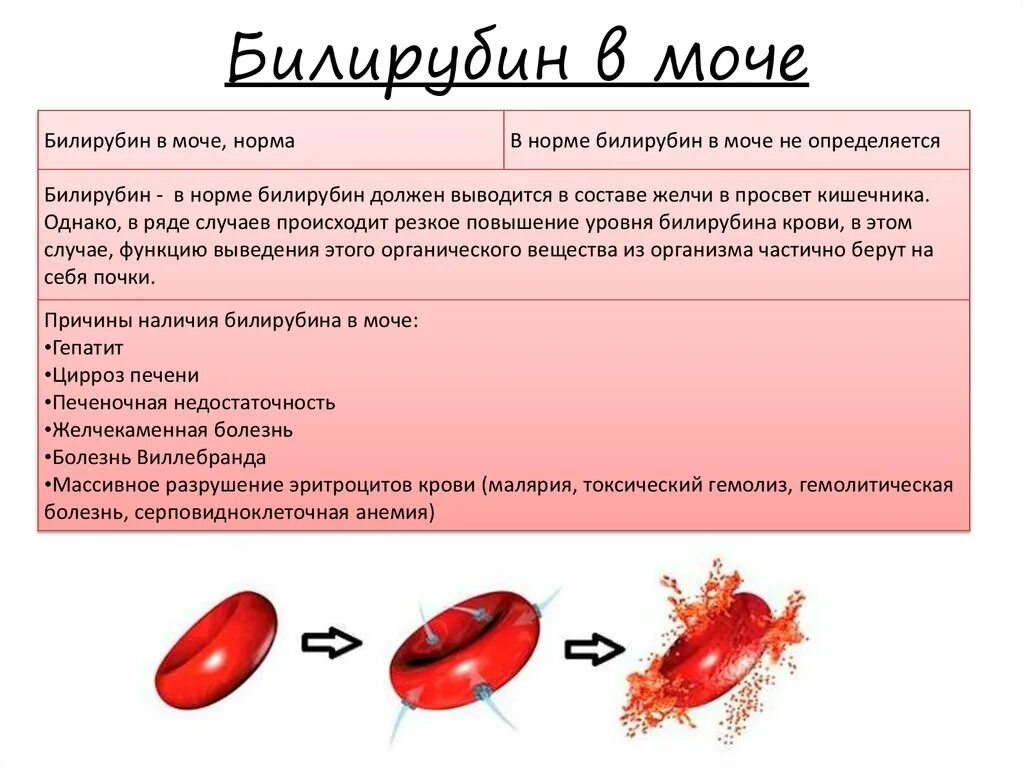 Норма непрямого билирубина в моче. Анализ мочи билирубин. Моча при билирубине. Билирубин в моче причины. Моча при вирусном гепатите