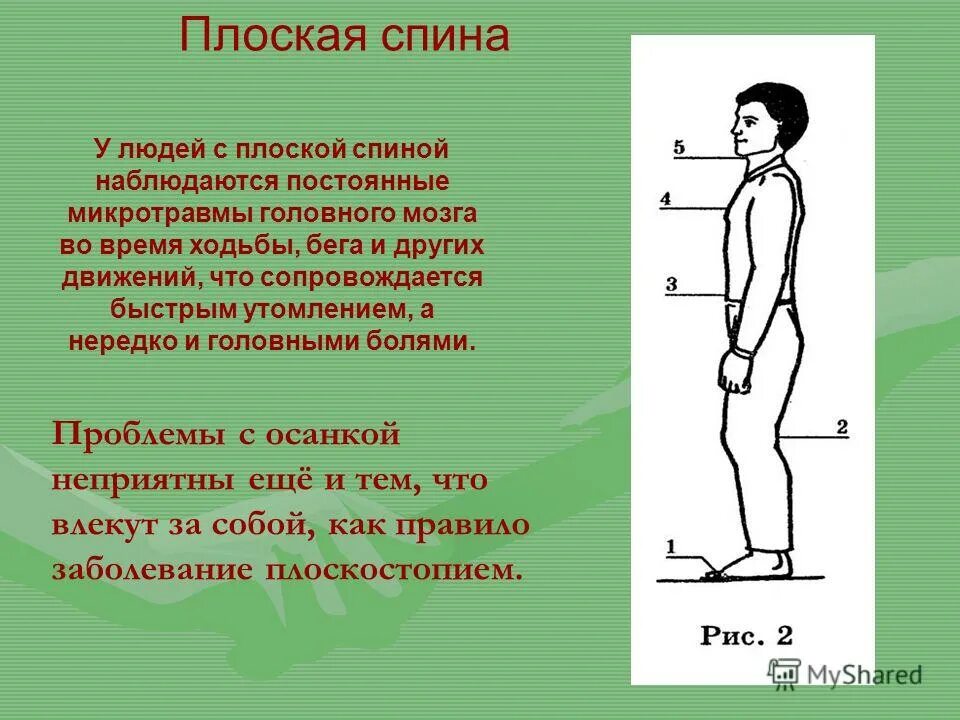 Таблица лордоз кифоз сколиоз. Что называется осанкой пружинные характеристики. Что называется осанкой пружинные характеристики. Что называется осанкой качество позвоночника. По физкультуре об осанке.