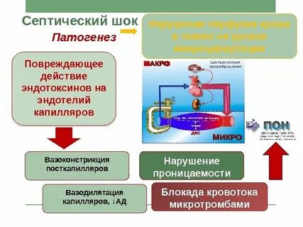 Септический шок это