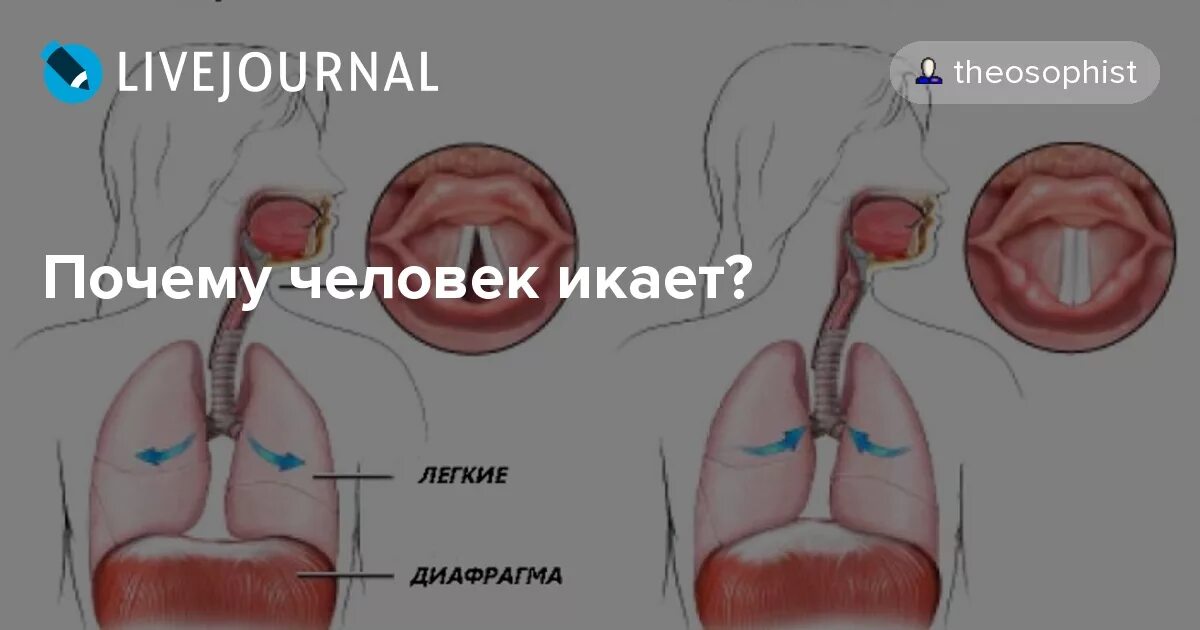 Почему икаешь и что делать. Почему человек икает. Почему человек икает причины. Почему человек почему человек икает. Почему постоянно икаю.