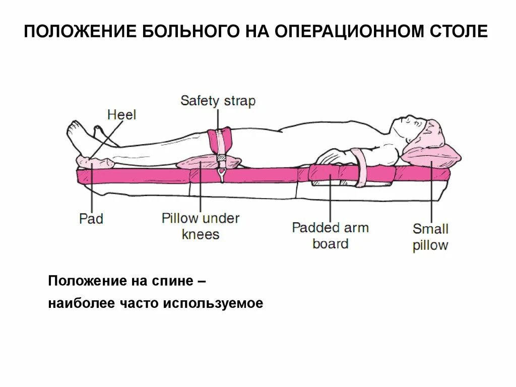 Положение больного на спине на операционном столе. Положение пациента на операционном столе при аппендэктомии. Положение пациента при операции. Позиции пациента на операционном столе.