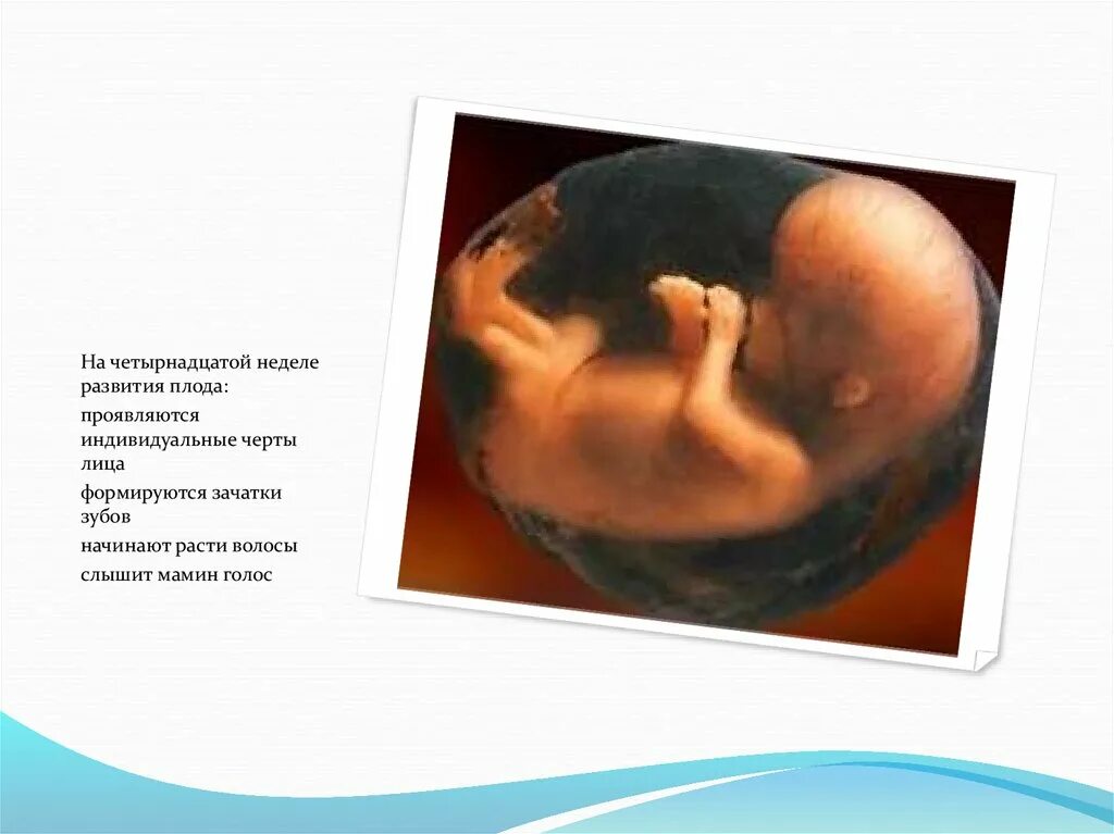 Задание 14 недели. Эмбрион 13-14 недель Размеры. Размер зародыша в 14 недель беременности. Недели беременности 14 недель. Плод на 14 неделе беременности.