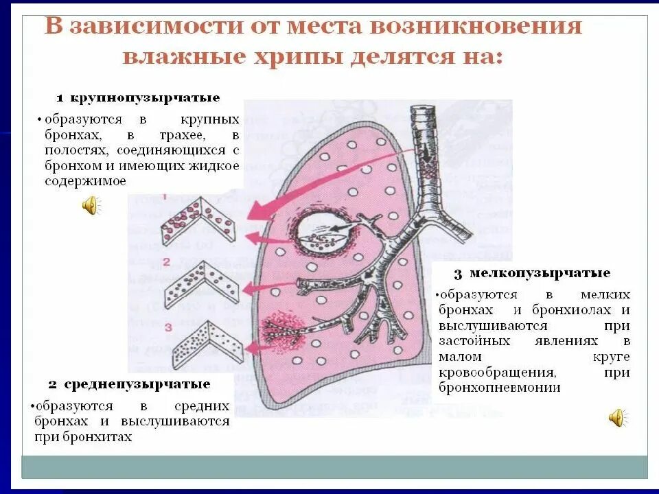 Дыхание со свистом у взрослых. Хрипы в легких. Хрипение в легких при дыхании. Влажные хрипы в легких.