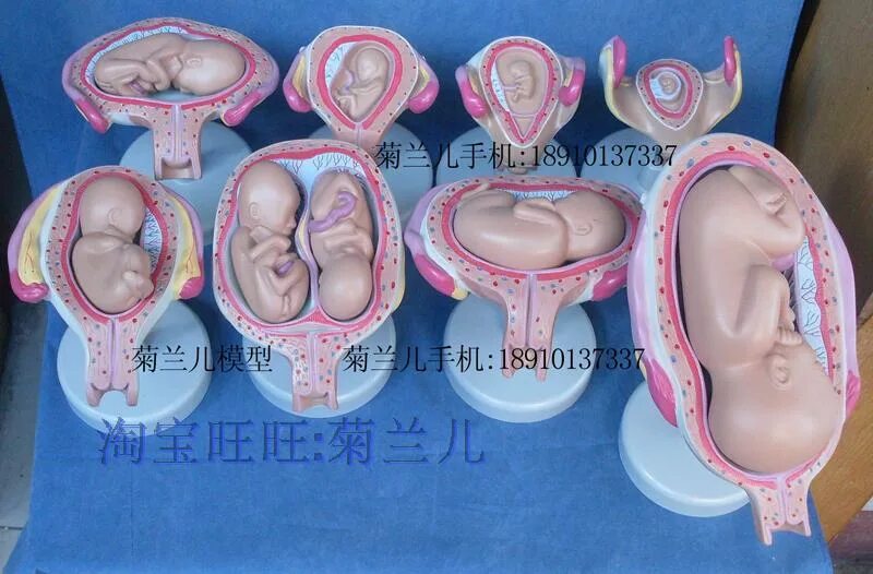 22 неделя двойней. Узи плода ребенка на 22 неделе беременности. Узи 22 недели беременности двойня. Узи двойни на 32 неделе беременности. 22 неделя двойней.