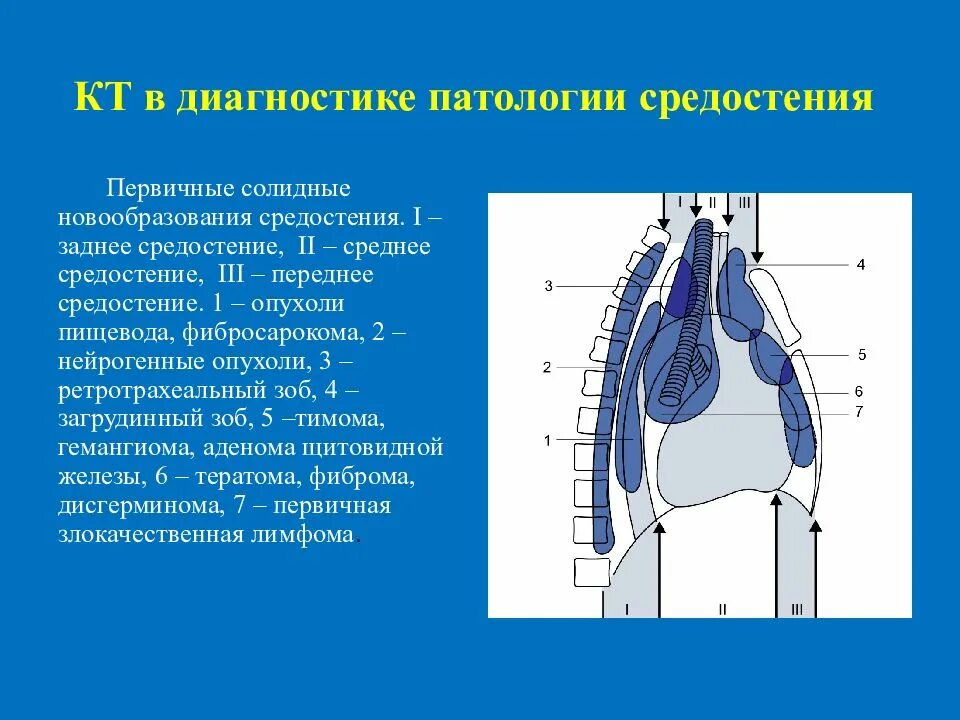 Образование заднего средостения