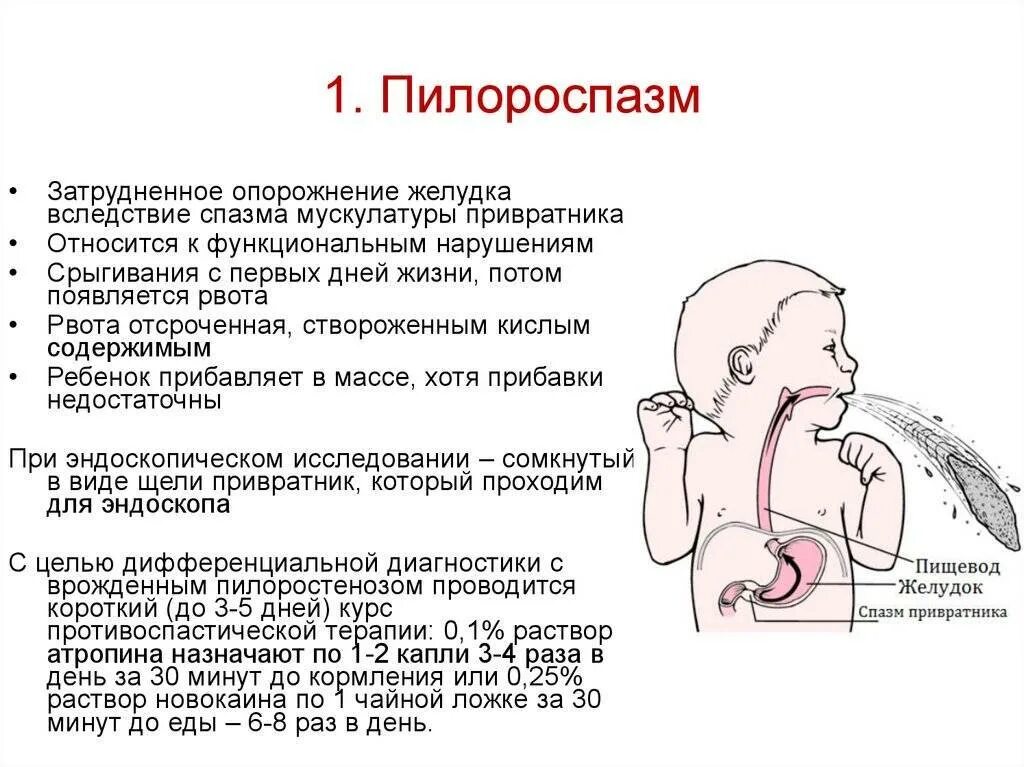 Почему новорожденный срыгивает после кормления фонтаном. Пилороспазм симптомы у грудных детей. Пилоростеноз и пилороспазм у новорожденных. Рвота у ребенка грудничка.