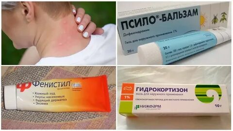 Укусы мошек мази