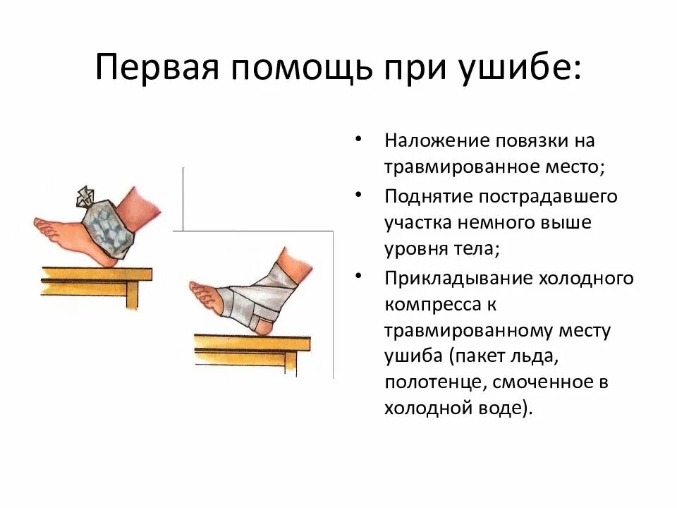 Сильный ушиб помощь. При 1 помощь при ушибе. Оказание первой помощи при ушибах. Первая помощь при закрытых травмах. Оказание первой помощи при ушибах конечностей.