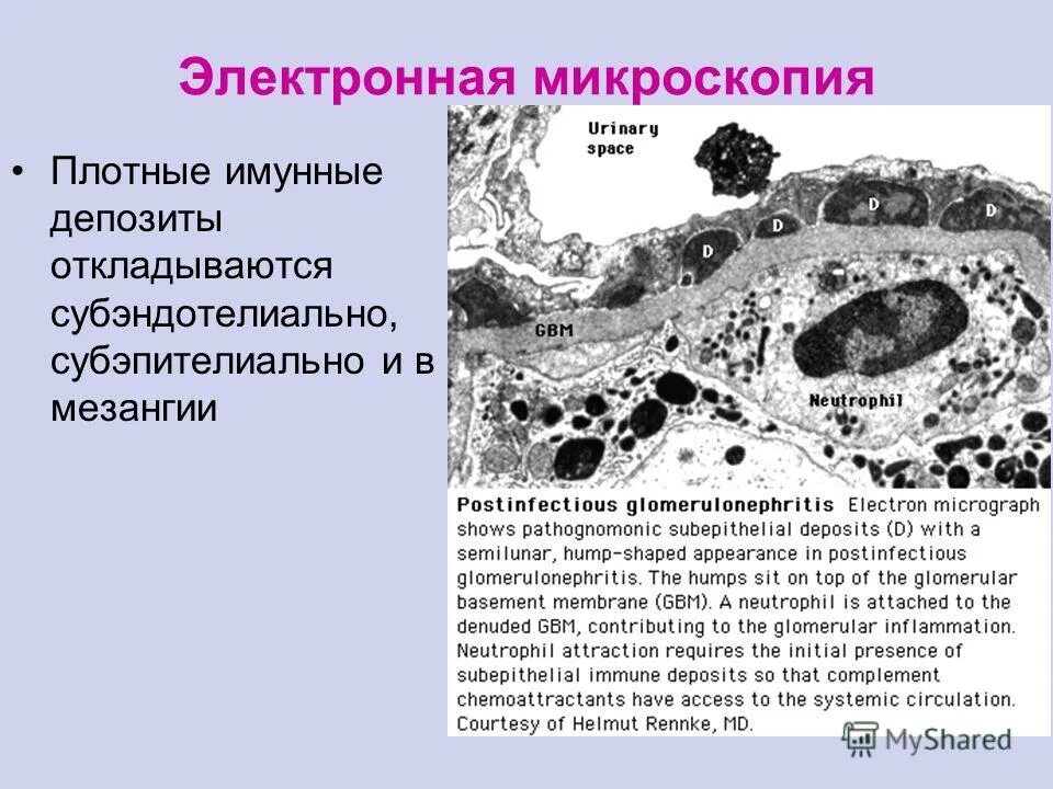 Появление электронной микроскопии. Появление электронной микроскопии